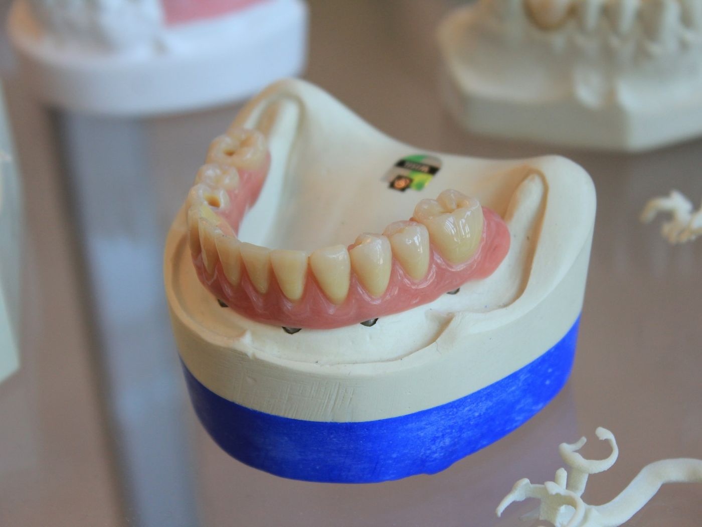 A dental laboratory model of a set of teeth used for planning tooth movement